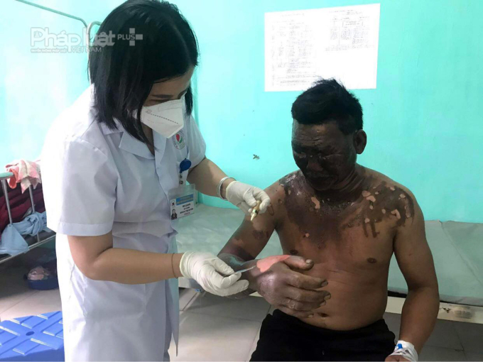 Hà Giang: Nổ bình gas mini trong khi ăn lẩu, một người nhập viện